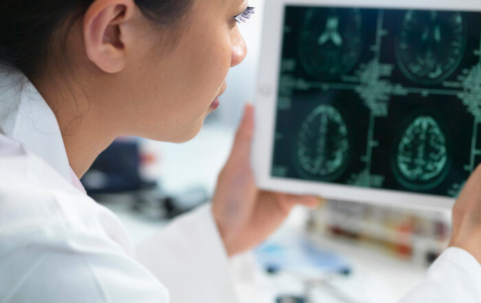 Woman looking at a brain scan showing that Addiction is a Brain Disorder